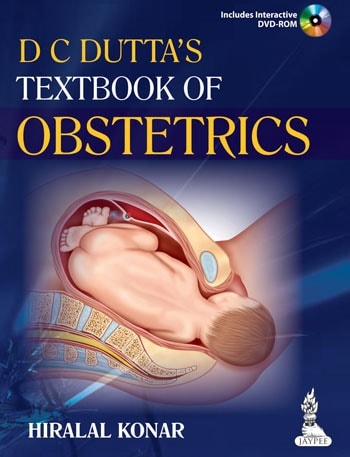 DC Dutta's Textbook of Obstetrics 7e