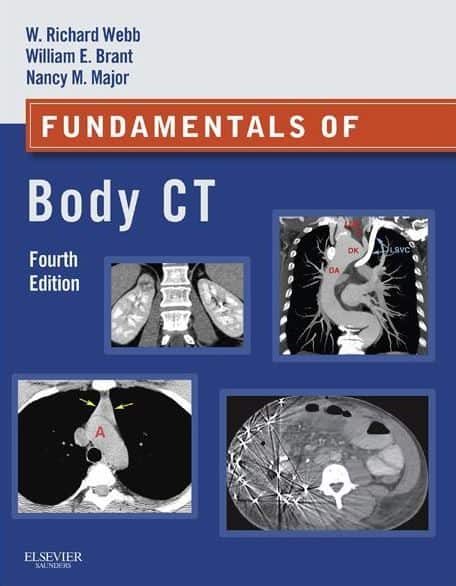 Fundamentals of Body CT, 4e