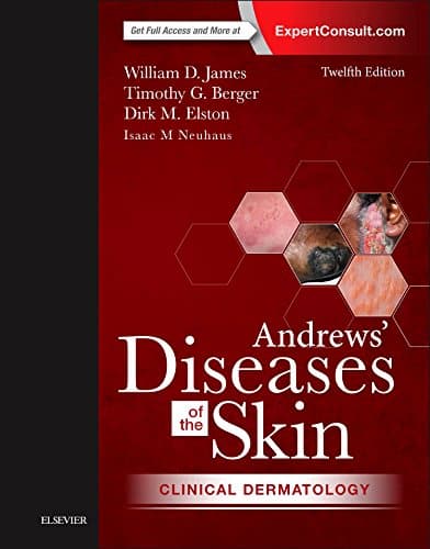 Andrews' Diseases of the Skin Clinical Dermatology, 12e