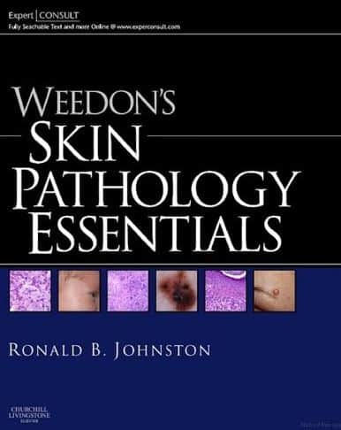 Weedon's Skin Pathology Essentials 1e