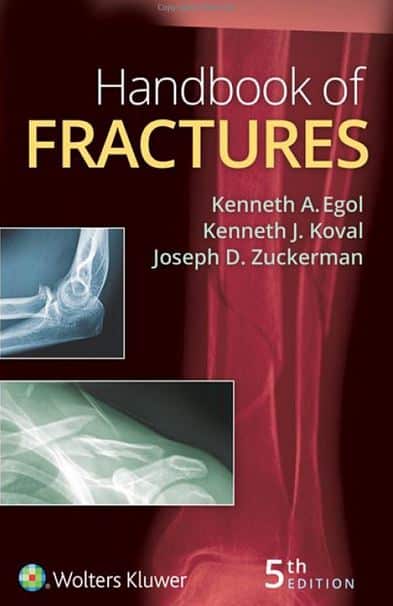 Handbook of Fractures 5e