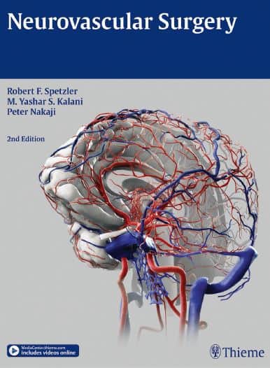 Neurovascular Surgery, 2nd Edition