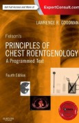Felson's Principles of Chest Roentgenology, A Programmed Text, 4e