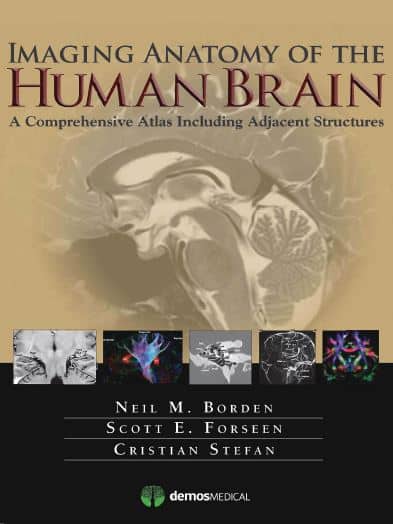 Imaging Anatomy of the Human Brain -A Comprehensive Atlas Including Adjacent Structures