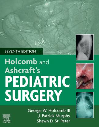 Holcomb and Ashcraft's Pediatric Surgery 7e